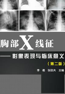 手表游戏